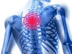 osteochondrosis sa rehiyon sa thoracic