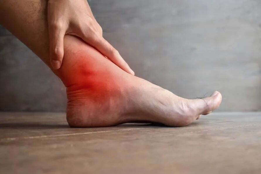 arthrosis sa ankle joint