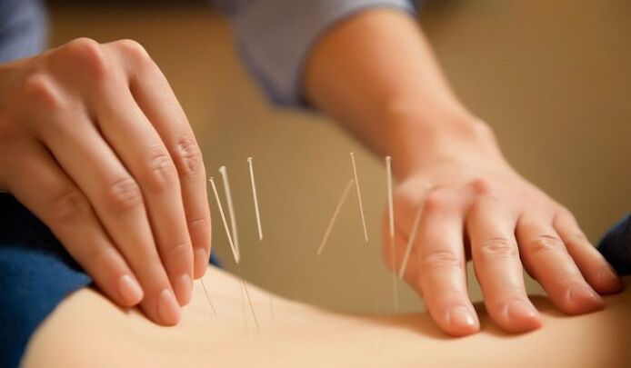 acupuncture aron matambal ang sakit sa ubos nga buko